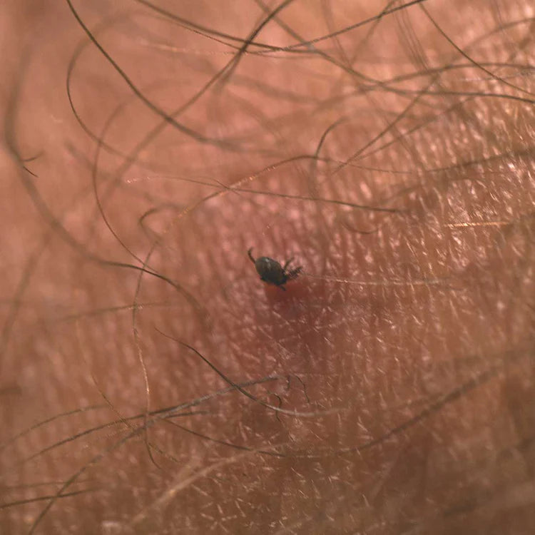 Tick Removal Card | LifeSystems | Portwest - The Outdoor Shop